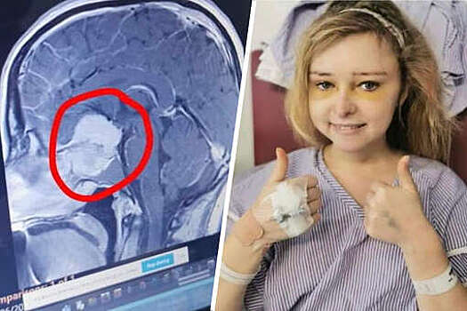 Goodnewsnetwork: во время осмотра у окулиста британка узнала, что у нее опухоль в мозге