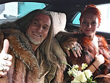 Пластический хирург рассказала, что случилось с лицом Марины Анисиной