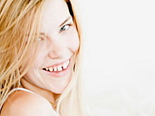 Топ 5 знаменитостей с некрасивыми зубами