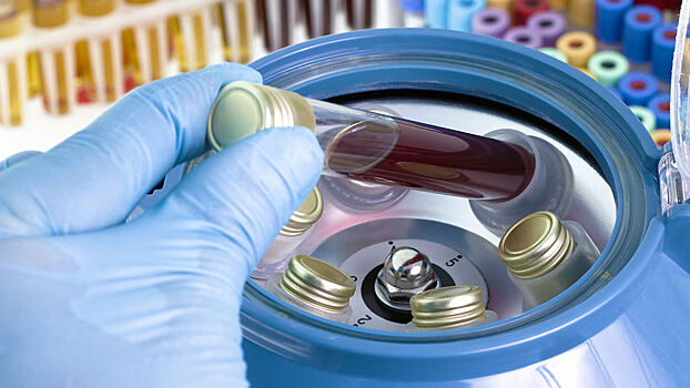 «Эпидемия продолжается»: открыт новый штамм ВИЧ