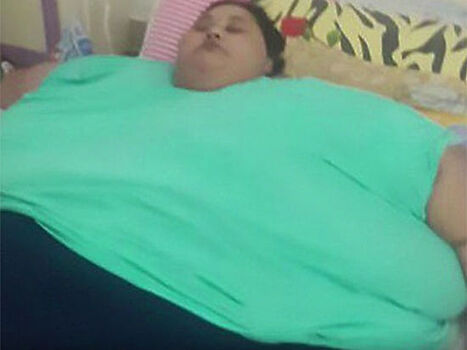 Самая толстая женщина: египтянке весом 500 кг сделают операцию в Индии