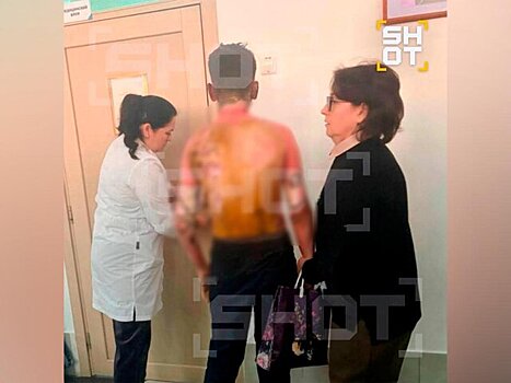 Трое детей попали в больницу с ожогами из школы в Красноярске