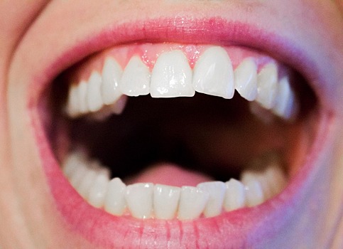 Ученые разработали зубной датчик для подсчета калорий