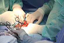 Могилевские трансплантологи впервые пересадили почку