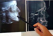 Главврач российской больницы сломал мужчине челюсть