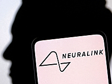 Первый пациент компании Neuralink научился управлять компьютерной мышью с помощью мысли