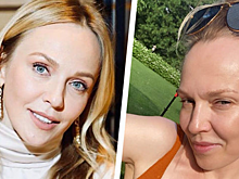 Время не щадит: звезды, которые резко постарели