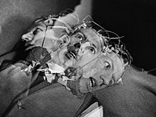 Бесчеловечная медицина: 4 неэтичных эксперимента