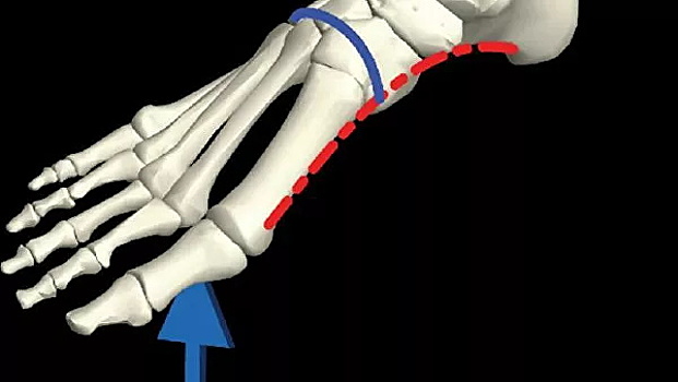 Математики раскрыли секрет устойчивости стопы человека