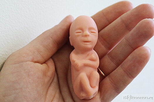Бороться с абортами врачам Тверской области предлагают с помощью резиновых трехмесячных младенцев