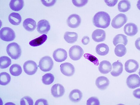 Найден способ остановить распространение малярии
