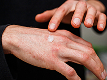 Псориаз: реально ли от него избавиться