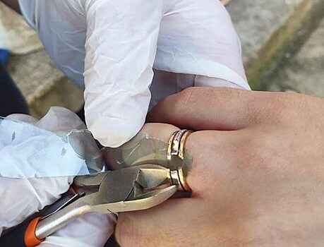 В Новороссийске спасатели помогли беременной женщине снять с пальца обручальное кольцо