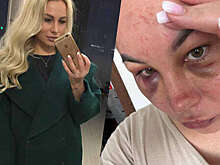 В Нефтекамске женщину забил сожитель