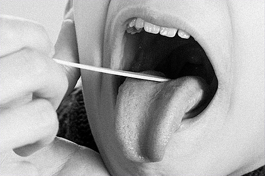 «Уральский синдром»: как чекисты и врачи искали возбудителя смертельной болезни