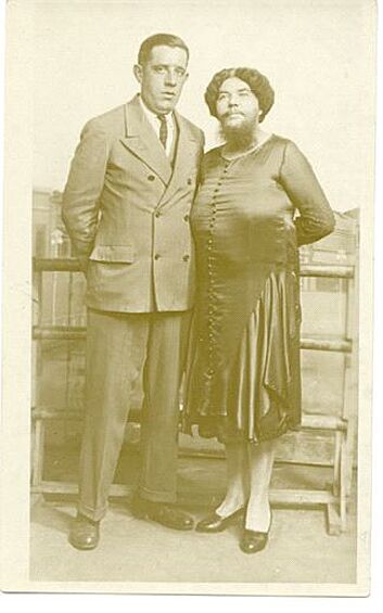 Джейн Барнелл (1871 год — неизвестно) выступала в американских цирках под псевдонимом Леди Ольга Родерик и даже снялась в фильме Тода Браунинга «Уродцы» в 1932 году. Ее борода достигала почти 30 см.