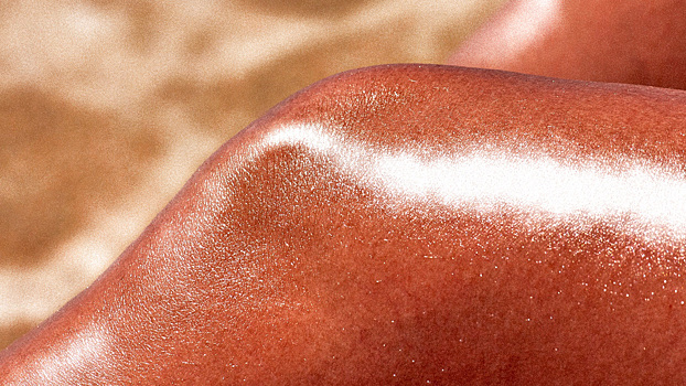 Сметана «не работает»: чем намазать кожу при солнечных ожогах, чтобы снять красноту и боль