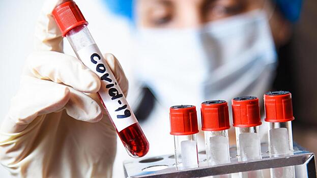 580 человек заболели коронавирусом в Вологде с начала эпидемии