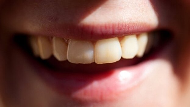 Ученым удалось создать «вечную» зубную пломбу