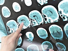 Превращение иммунных клеток в нейроны помогло мышам восстановиться после инсульта