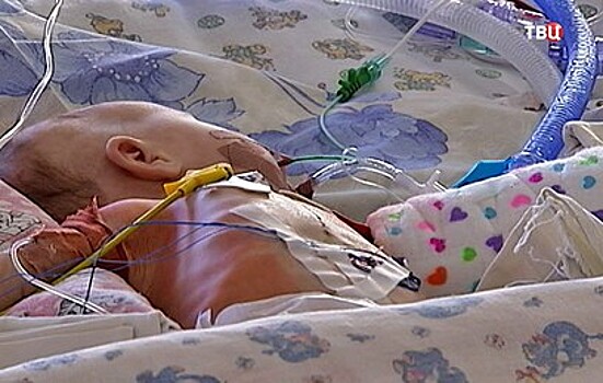 Питерские хирурги провели уникальную операцию на сердце младенца