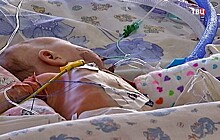 Питерские хирурги провели уникальную операцию на сердце младенца