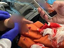 Десять рваных рублей: Мелкая купюра едва не лишила мальчика руки на детской площадке