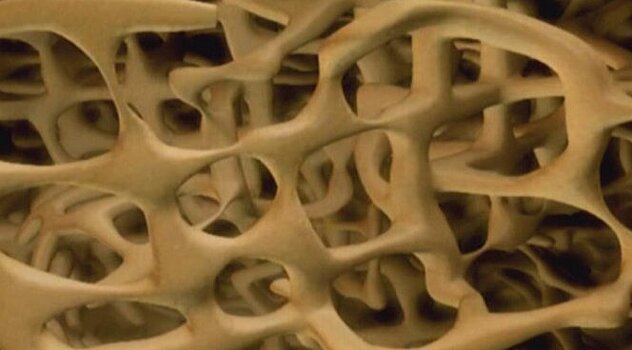 Создан материал для ортопедических имплантатов, превращающихся в костную ткань