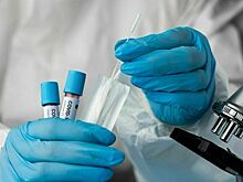 В Роспотребнадзоре не видят оснований для введения ограничений из-за COVID-19