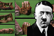 Зуб дают: ученые идентифицировали останки Гитлера