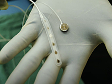 Конкурент Neuralink: миниатюрный мозговой интерфейс без проводов вживили человеку