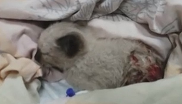 В Калининграде собирают деньги для юноши, потерявшего руки, спасая котенка