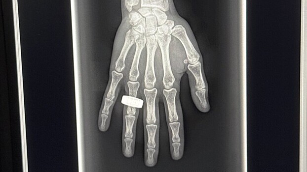 Опубликован первый рентгеновский снимок, сделанный в космосе