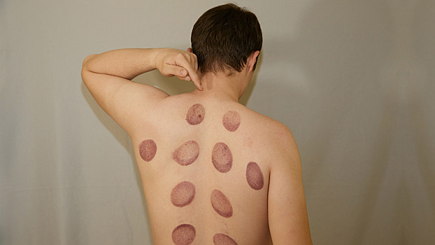 Россиян предупредили об опасных методах лечения