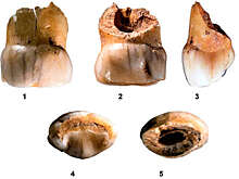 Археологи обнаружили молочные зубы юных неандертальцев