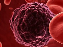 В Японии лечением раковых заболеваний займется искусственный интеллект