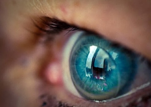 Контактные линзы могут привести к потере зрения
