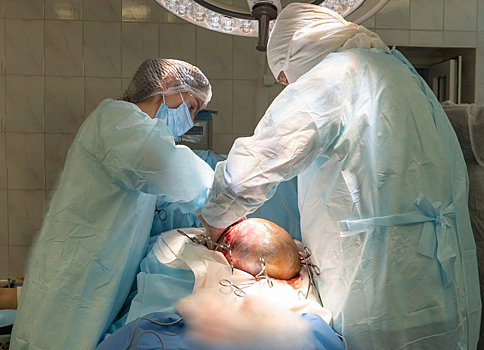 Гигантская десятикилограммовая опухоль выросла в яичнике жительницы Кузбасса