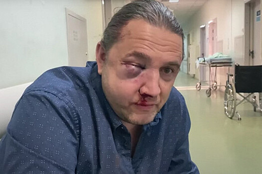 Опубликовано полное видео нападения на экс-депутата Госдумы Шингаркина