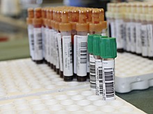 Низкие уровни лимфоцитов в крови могут указывать на повышенный риск смерти