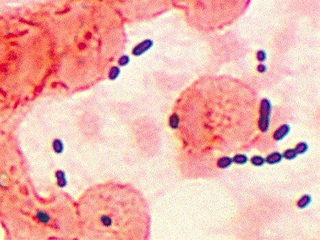Бактерия Enterococcus