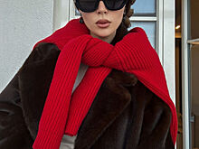 Анна Заворотнюк сделала подтяжку лица