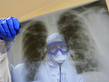 Иммунолог рассказал о самом тревожном симптоме коронавируса