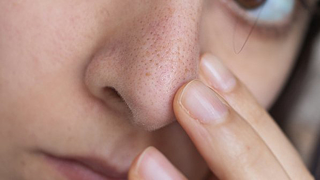 Что такое сальные нити и почему их нельзя трогать VOICE Дзен