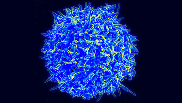 Перехитрить рак: модифицированные иммунные клетки натравили на лимфому