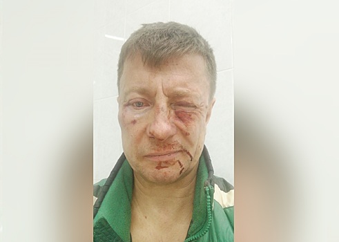 «Схватил за шею, давил на кадык»: в Екатеринбурге жители дома напали на управляющего ТСЖ