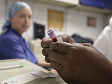 Названа причина самого распространенного типа рака