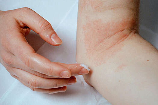 Установлено, что кремы для кожи приводят к проблемам с костями