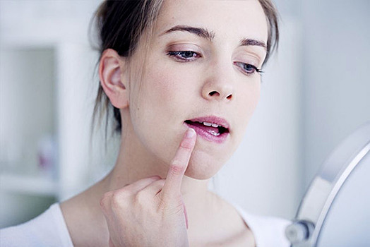 Как быстро избавиться от простуды на губах