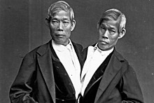 Как сложилась судьба самых известных сиамских близнецов Чанга и Энга Банкеров